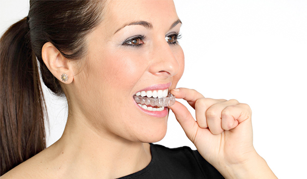 ortodoncia invisible invisalign zaragoza